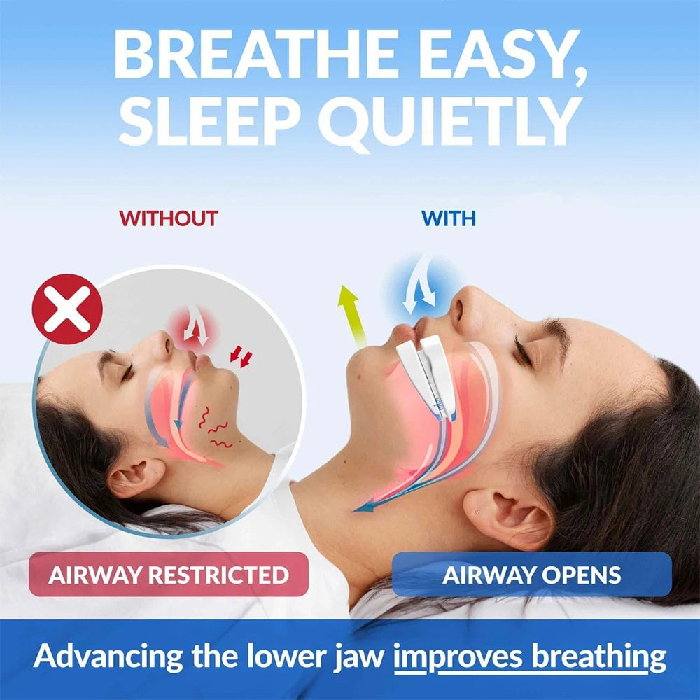 Anti-snoring mouthpiece