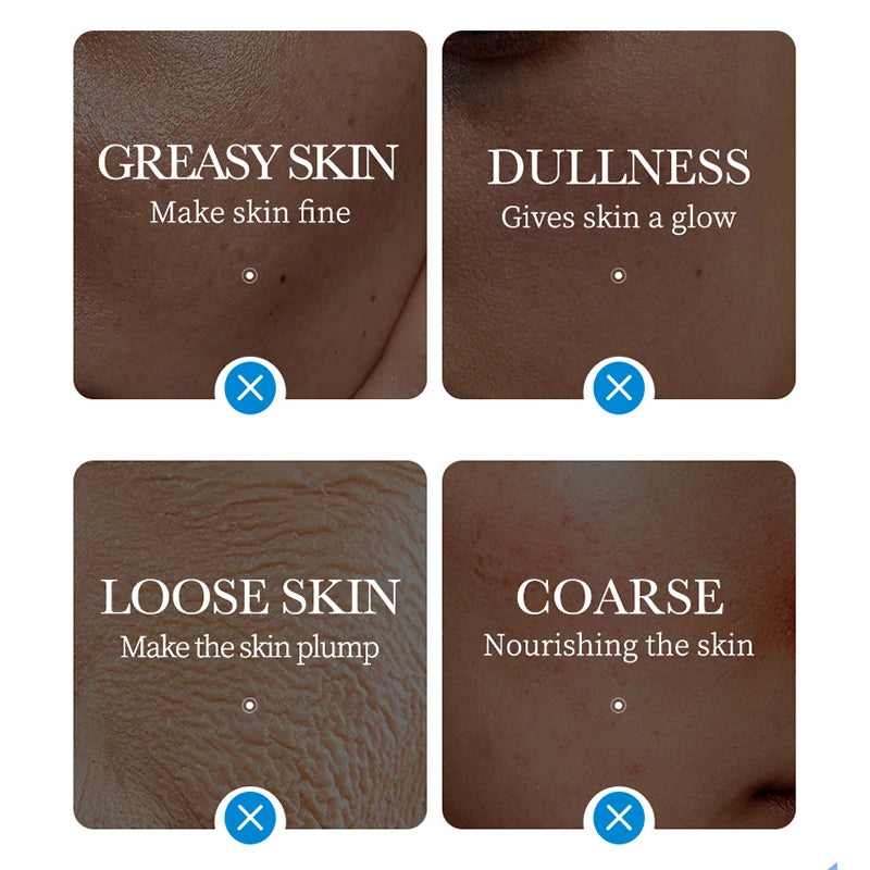 Ice masks for deep hydration and illumination