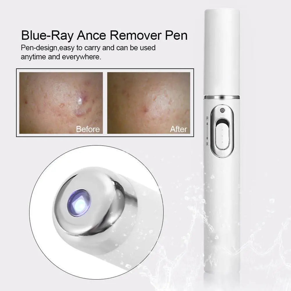 High quality mole and wart remover pen