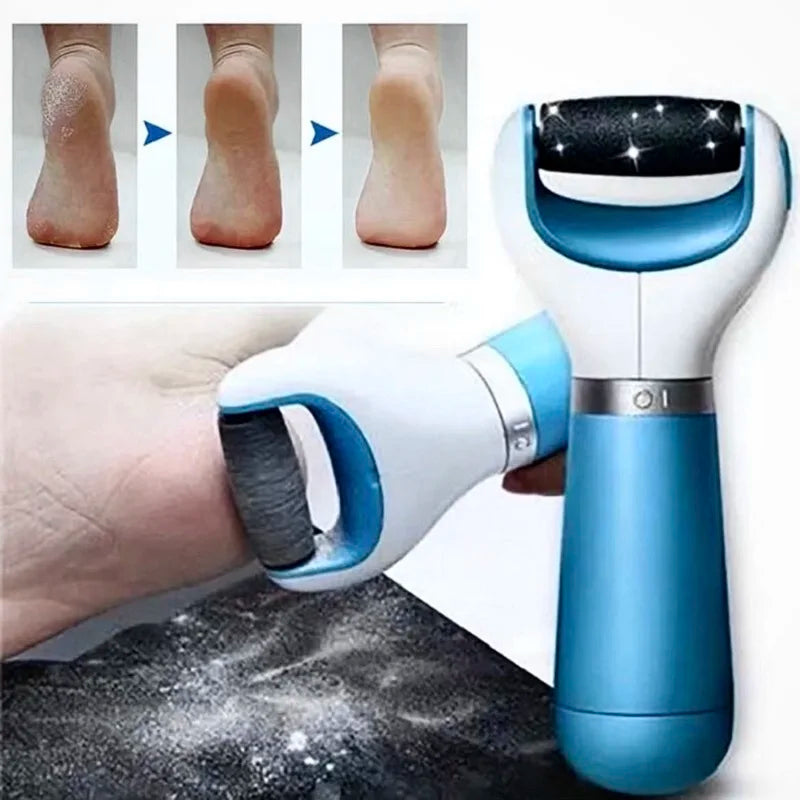Callus and dead skin remover for feet
